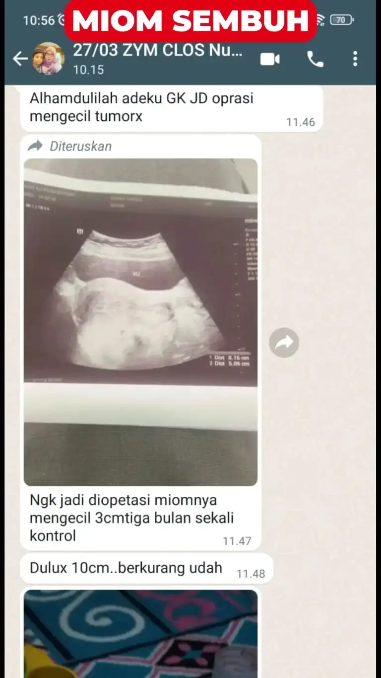 ezgif.com-webp-maker - 2024-10-21T092635.528